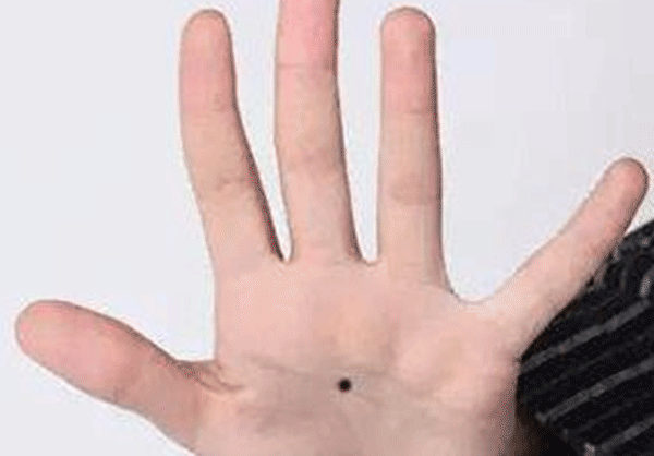 女人10处有痣是富贵痣，女人身上的10大福痣